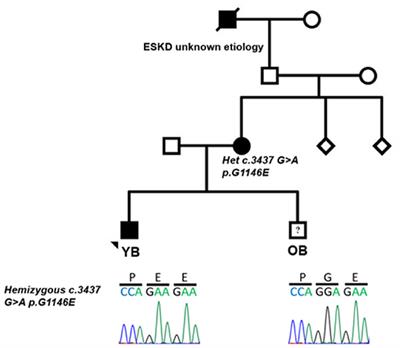 Case Report: Unusual Aggregation of Different Glomerulopathies in a Family Resolved by Genetic Testing and Reverse Phenotyping